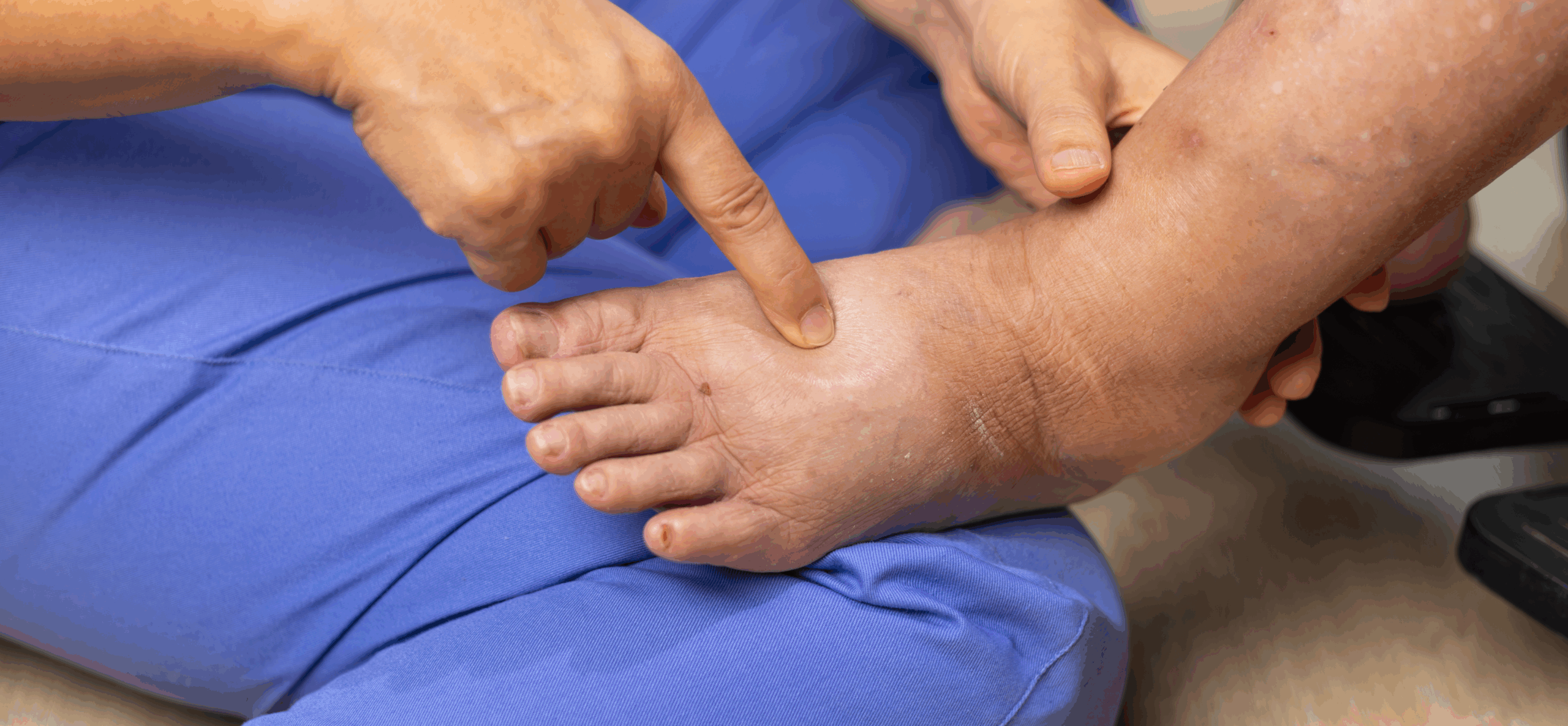 Complete Diabetic Foot Assessment